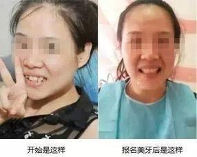 成人牙丑视频播放网站,热门内容与观看指南
